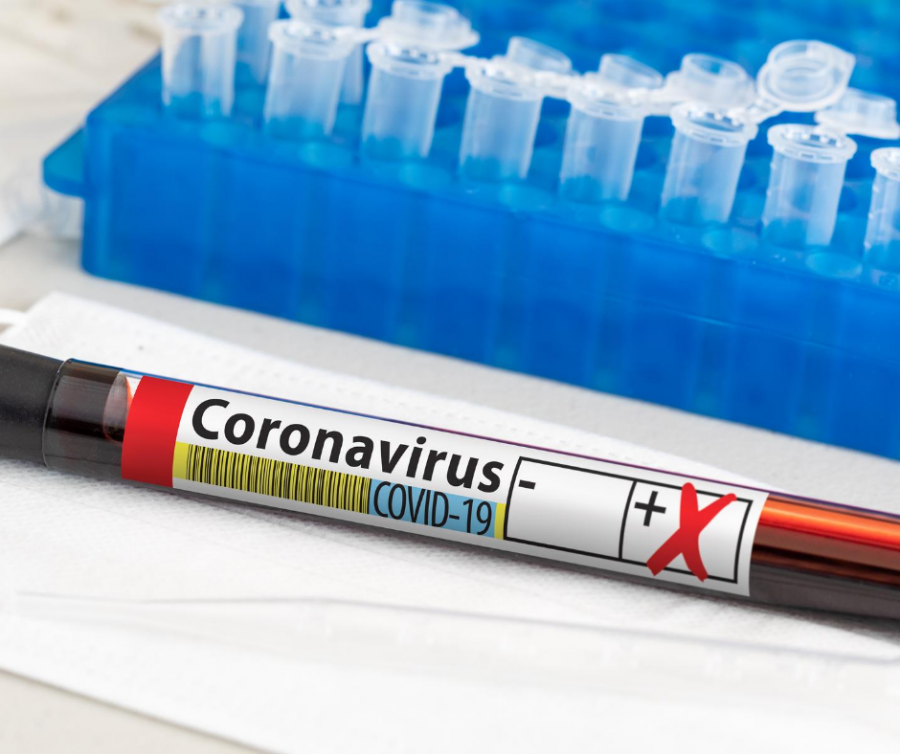 Corona, Positiv, Test, Testergebnis, Befund, Coronavirus, Virus, Testung. - canva.com